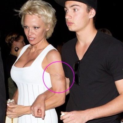 Pamela Anderson Finally Removing Old-School Barbed Wire Tattoo