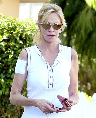 An Aging Melanie Griffith Ditches the Cover-Up and Opts for Legit Removal of “Antonio” Tat